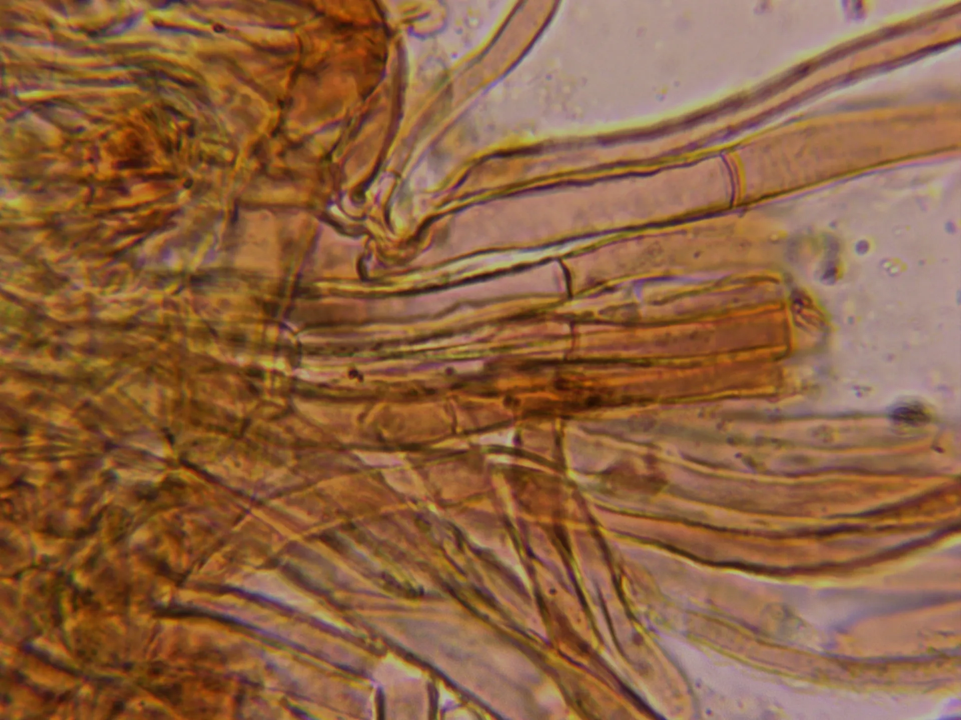 Microscopía de Tricholoma sejunctum - 18 - Cutícula sin fíbulas